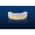 Customized Dental Zirconia Ceramic Teeth